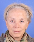 Before Hair Transplant &nbsp;Hair Thinning